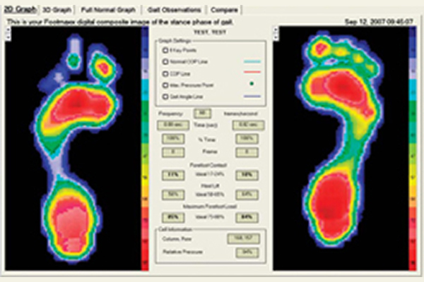 Two images of scans of bare feet