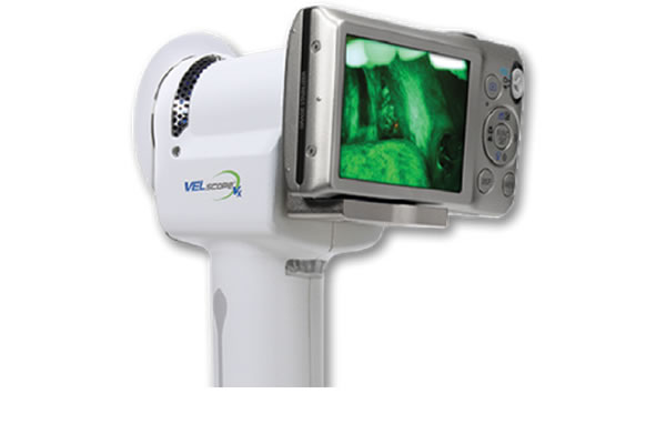 velscope device for technologically advanced oral cancer screening